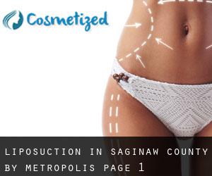 Liposuction in Saginaw County by metropolis - page 1