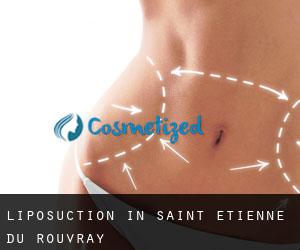 Liposuction in Saint-Étienne-du-Rouvray