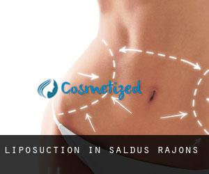 Liposuction in Saldus Rajons