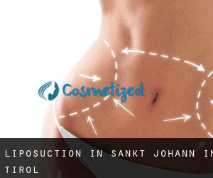 Liposuction in Sankt Johann in Tirol