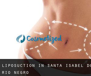 Liposuction in Santa Isabel do Rio Negro