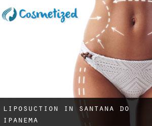 Liposuction in Santana do Ipanema