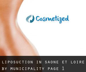 Liposuction in Saône-et-Loire by municipality - page 1