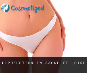 Liposuction in Saône-et-Loire