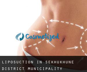 Liposuction in Sekhukhune District Municipality