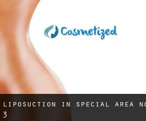 Liposuction in Special Area No. 3