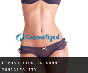 Liposuction in Sunne Municipality
