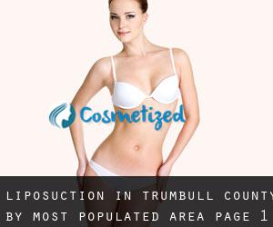 Liposuction in Trumbull County by most populated area - page 1