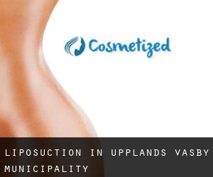 Liposuction in Upplands Väsby Municipality