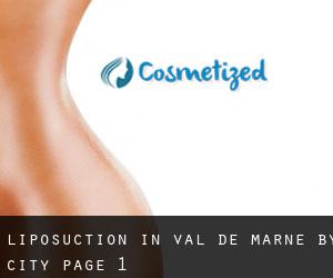 Liposuction in Val-de-Marne by city - page 1