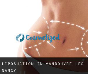 Liposuction in Vandœuvre-lès-Nancy