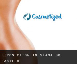 Liposuction in Viana do Castelo