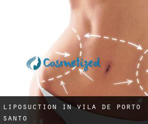 Liposuction in Vila de Porto Santo