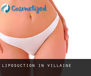 Liposuction in Villaine