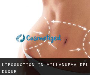 Liposuction in Villanueva del Duque