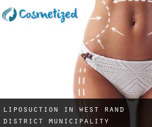 Liposuction in West Rand District Municipality