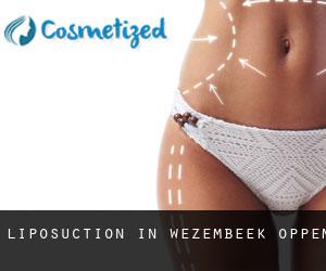 Liposuction in Wezembeek-Oppem