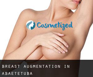 Breast Augmentation in Abaetetuba