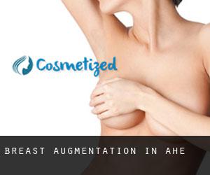 Breast Augmentation in Ahe