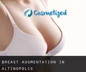 Breast Augmentation in Altinópolis