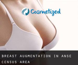 Breast Augmentation in Anse (census area)