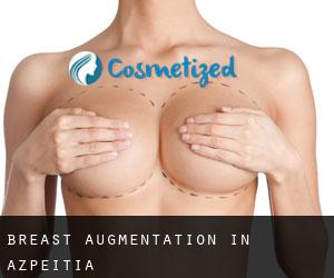 Breast Augmentation in Azpeitia Breast Augmentation in Azpeitia