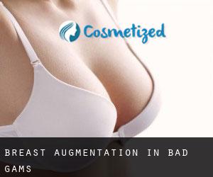 Breast Augmentation in Bad Gams