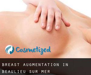 Breast Augmentation in Beaulieu-sur-Mer