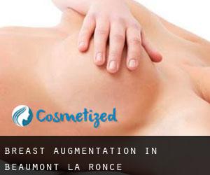 Breast Augmentation in Beaumont-la-Ronce