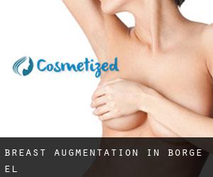 Breast Augmentation in Borge (El)