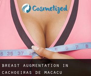 Breast Augmentation in Cachoeiras de Macacu
