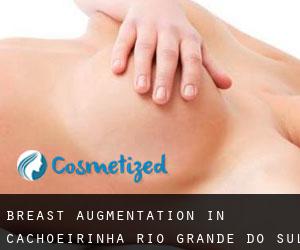 Breast Augmentation in Cachoeirinha (Rio Grande do Sul)