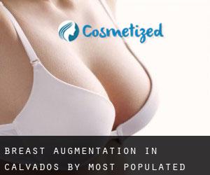 Breast Augmentation in Calvados by most populated area - page 2