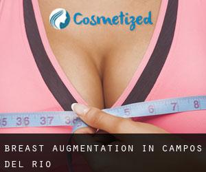 Breast Augmentation in Campos del Río