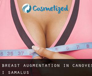 Breast Augmentation in Cànoves i Samalús
