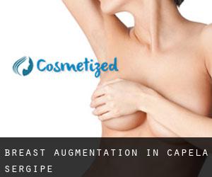 Breast Augmentation in Capela (Sergipe)