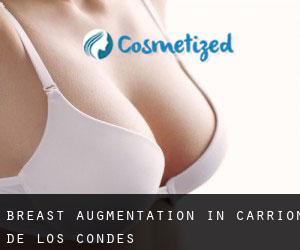 Breast Augmentation in Carrión de los Condes