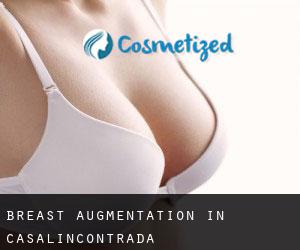 Breast Augmentation in Casalincontrada