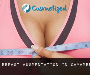 Breast Augmentation in Cayambe