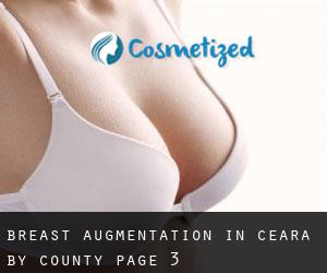 Breast Augmentation in Ceará by County - page 3