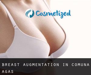 Breast Augmentation in Comuna Agăş