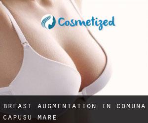 Breast Augmentation in Comuna Cãpuşu Mare