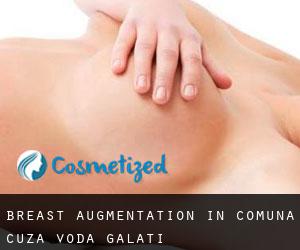 Breast Augmentation in Comuna Cuza Vodă (Galaţi)