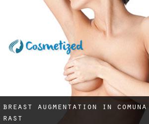 Breast Augmentation in Comuna Rast
