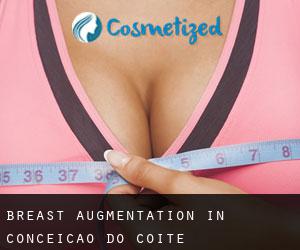 Breast Augmentation in Conceição do Coité