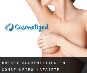 Breast Augmentation in Conselheiro Lafaiete