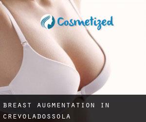 Breast Augmentation in Crevoladossola
