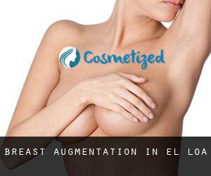 Breast Augmentation in El Loa