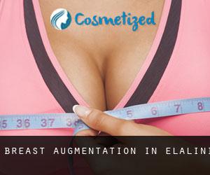 Breast Augmentation in eLalini
