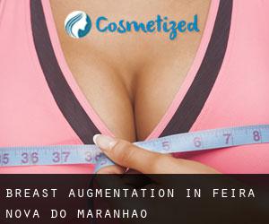 Breast Augmentation in Feira Nova do Maranhão